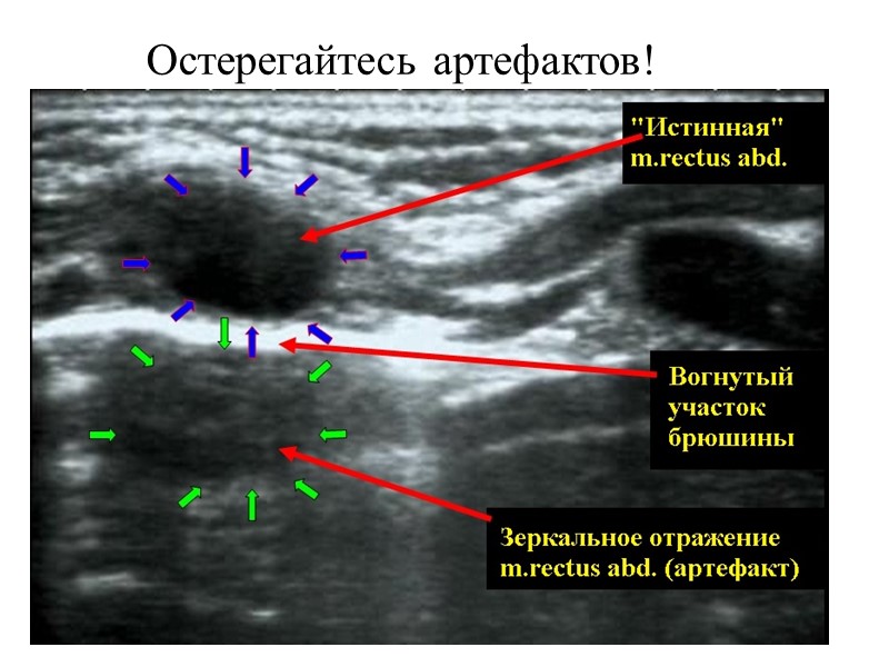 Остерегайтесь артефактов!
